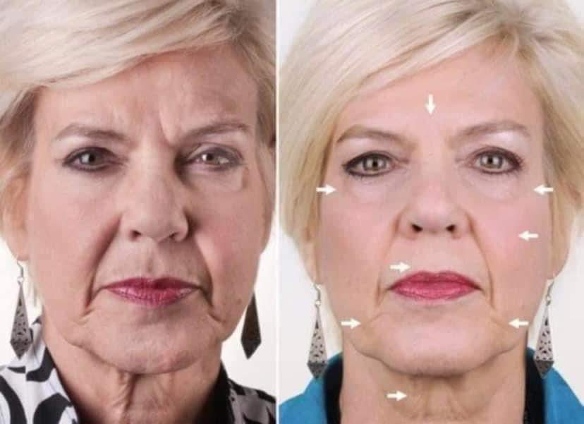 Uplifting Cream for Face