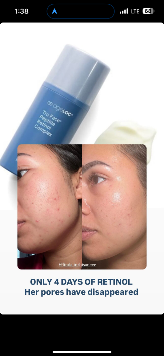 Retinol