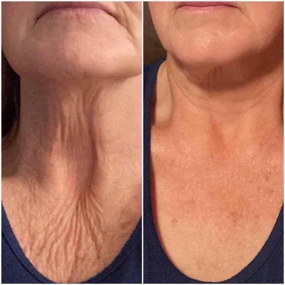 Skin Firming Cream