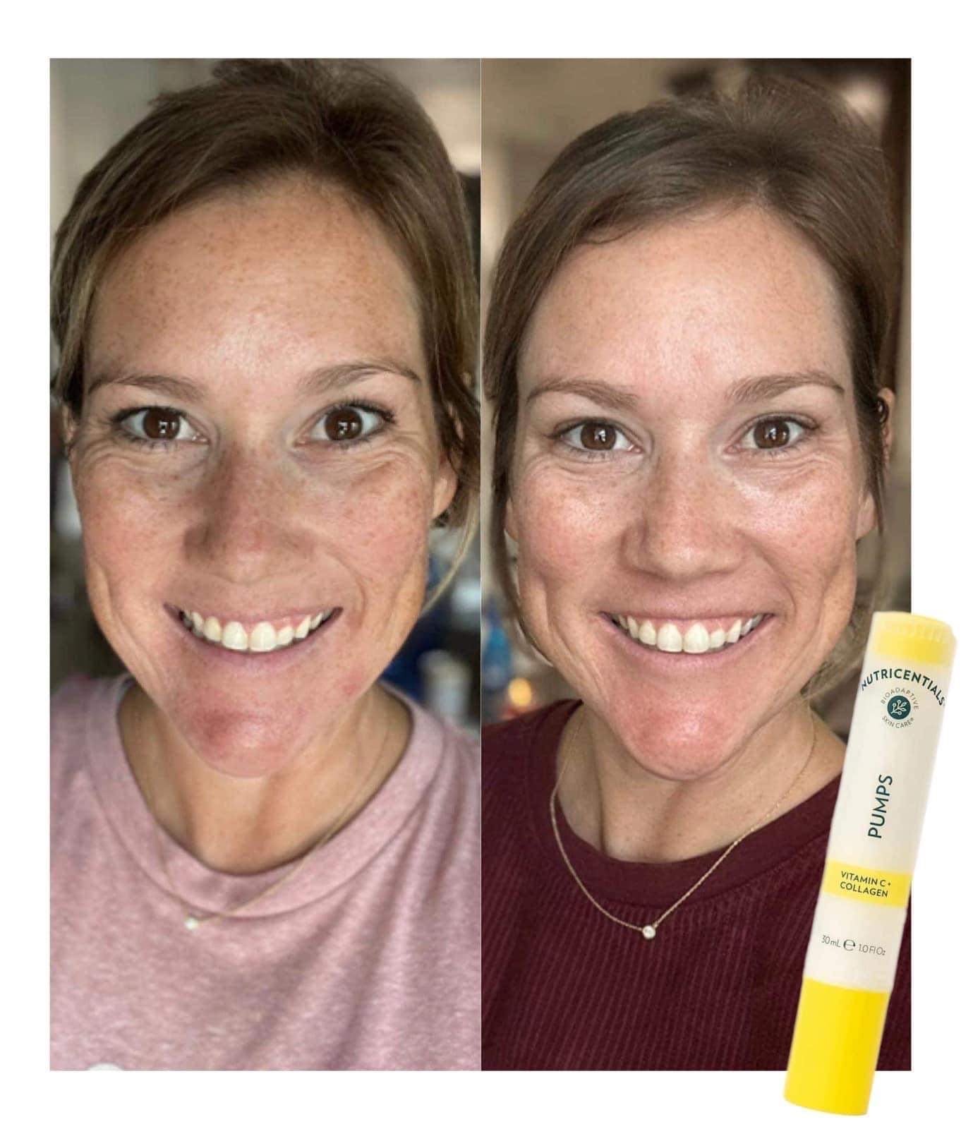 Vitamin C + Collagen Pump